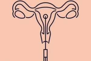 人工授精的过程是什么样的（植物人工授精的过程）