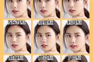 额头长痘痘是什么原因怎么调理女性(额头长痘痘是什么原因怎么调理中医)