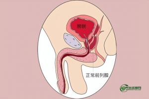 前列腺保健按摩方法(前列腺保健按摩是什么意思)