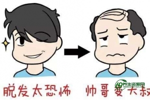 溢脂性脱发怎么治疗最彻底（溢脂性脱发和雄激素脱发有什么区别有什么不同）